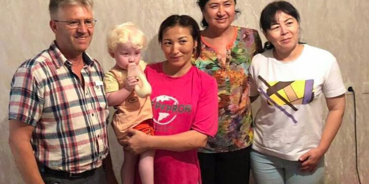 ГЕРМАНИЯДА ТҰРАТЫН ТҮРКІСТАНДЫҚ ТҮЛЕК БҮЛДІРШІННІҢ ЕМІ ҮШІН КӨМЕК КӨРСЕТТІ